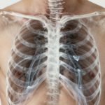 Hoe een r&ouml;ntgenfoto werkt en wat je erop herkent